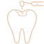 Зубнал лечение кариеса разного типа сложности